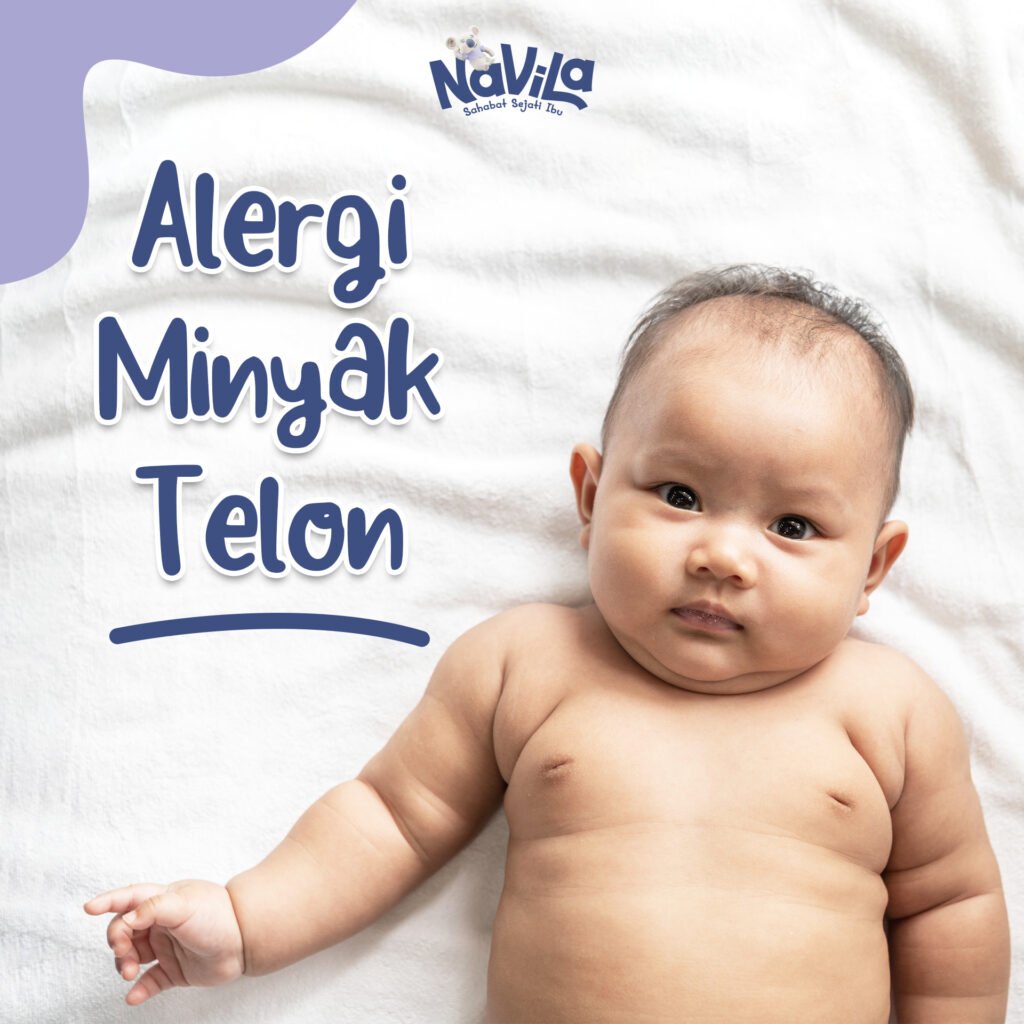 Cara Mengatasi Bayi yang Alergi Minyak Telon