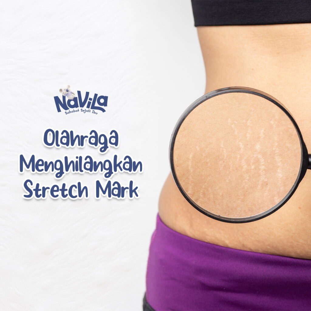 Olahraga untuk Menghilangkan Stretch Mark