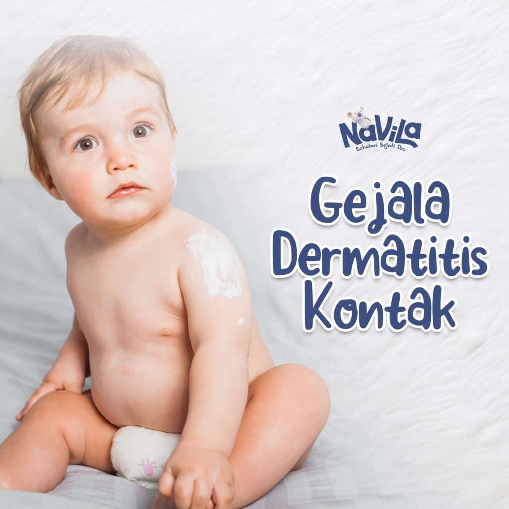 Gejala dan Tanda Awal Dermatitis Kontak yang Sering Diabaikan