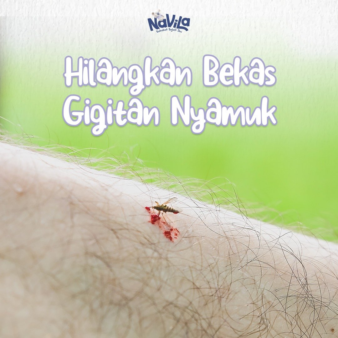 5 Cara Ampuh Menghilangkan Bekas Gigitan Nyamuk pada Bayi