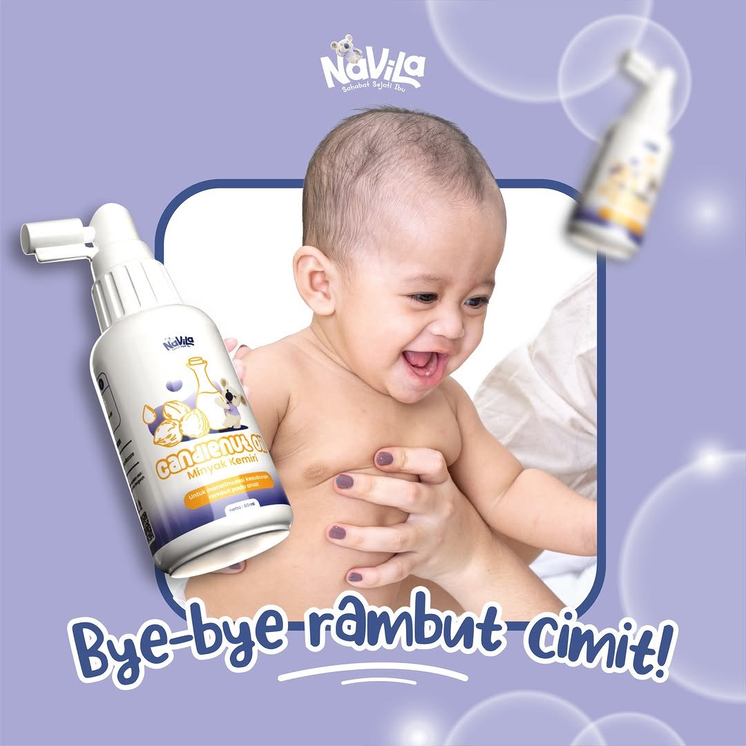 Rambut Bayi Rontok ? Navila Candlenut Oil Solusinya