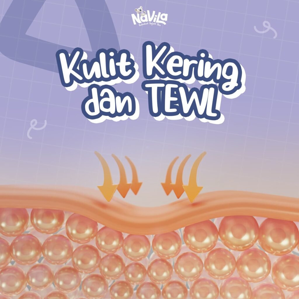 Kulit Kering dan TEWL, Apa Hubungannya