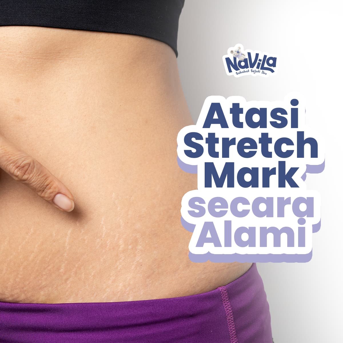 Apakah Stretch Mark Bisa Hilang Ini Rahasia Alami yang Terbukti Ampuh!