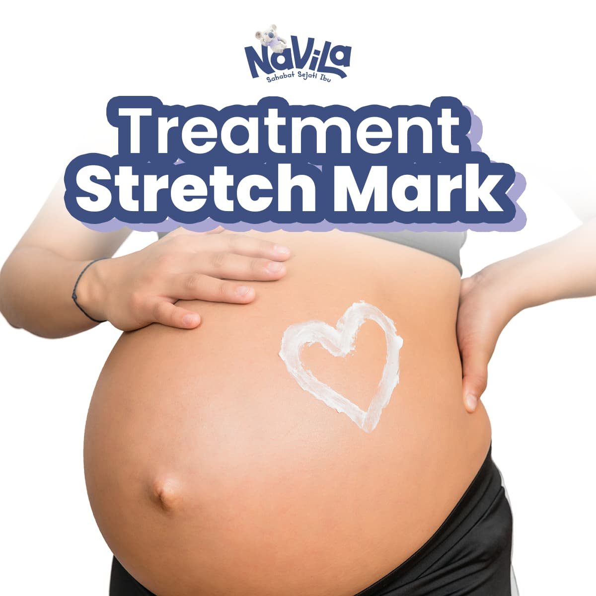5 Bahan Alami Terbaik untuk Perawatan Stretch Mark Bumil