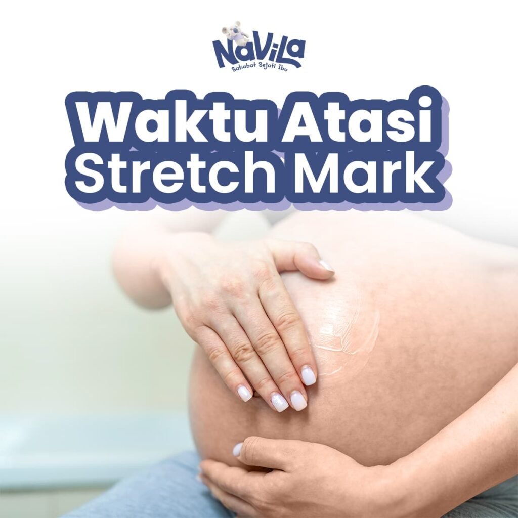 Apakah Stretch Mark Bisa Hilang Sepenuhnya Fakta yang Perlu Diketahui Ibu Hamil