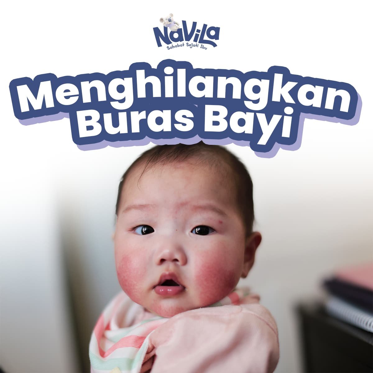 Cara Menghilangkan Buras di Wajah Bayi Secara Alami dan Aman
