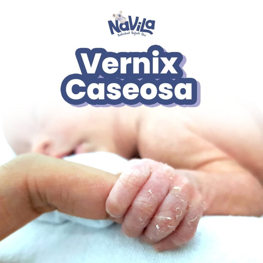 Kulit Bayi Newborn Mengelupas, Berbahaya atau Normal