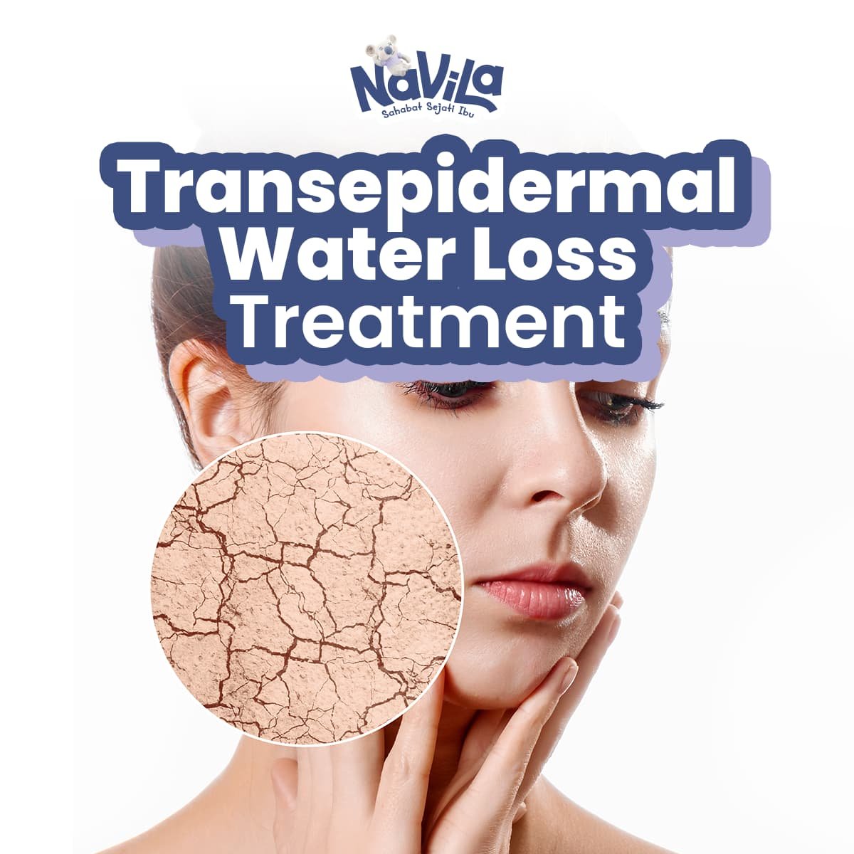 Kulit Kusam Bisa Jadi Karena TEWL Tinggi! Ini Treatment untuk Atasinya