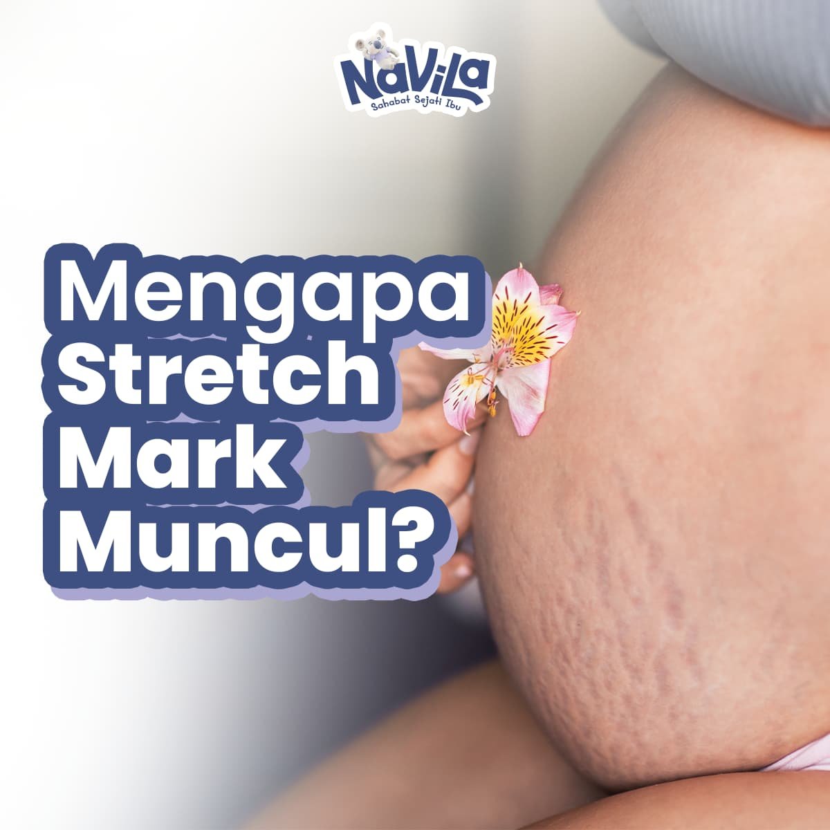 Mengapa Stretch Mark Muncul Saat Hamil dan Apa Bisa Dicegah
