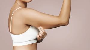 Stretch Marks on Upper Arms (Armpit Area)