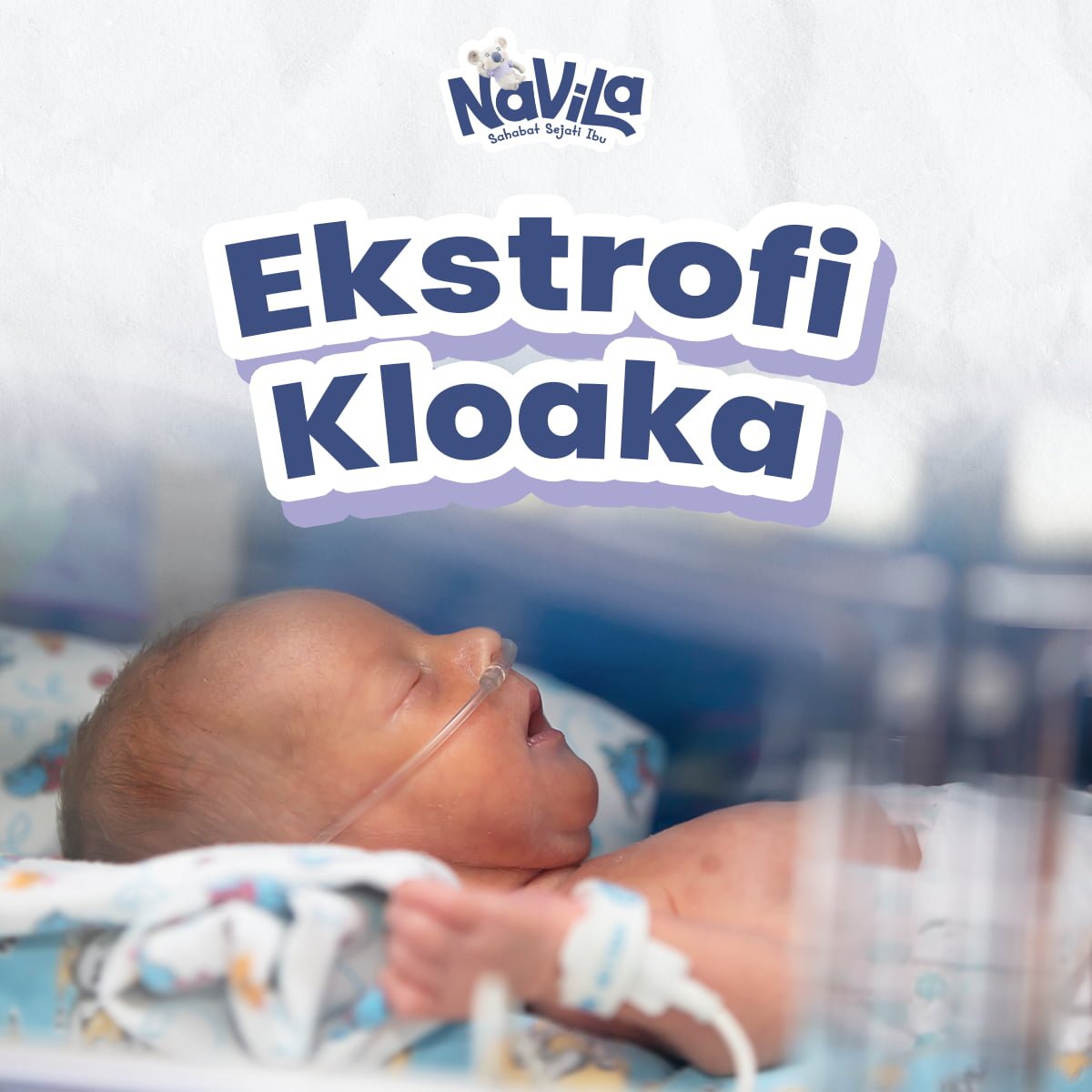 Ekstrofi Kloaka, Kelainan Langka pada Kandung Kemih Bayi