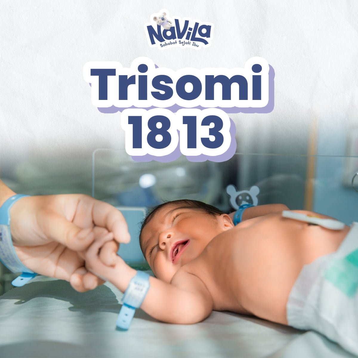 Kenali Trisomy 18 dan 13 dari Risiko, Gejala dan Penanganannya