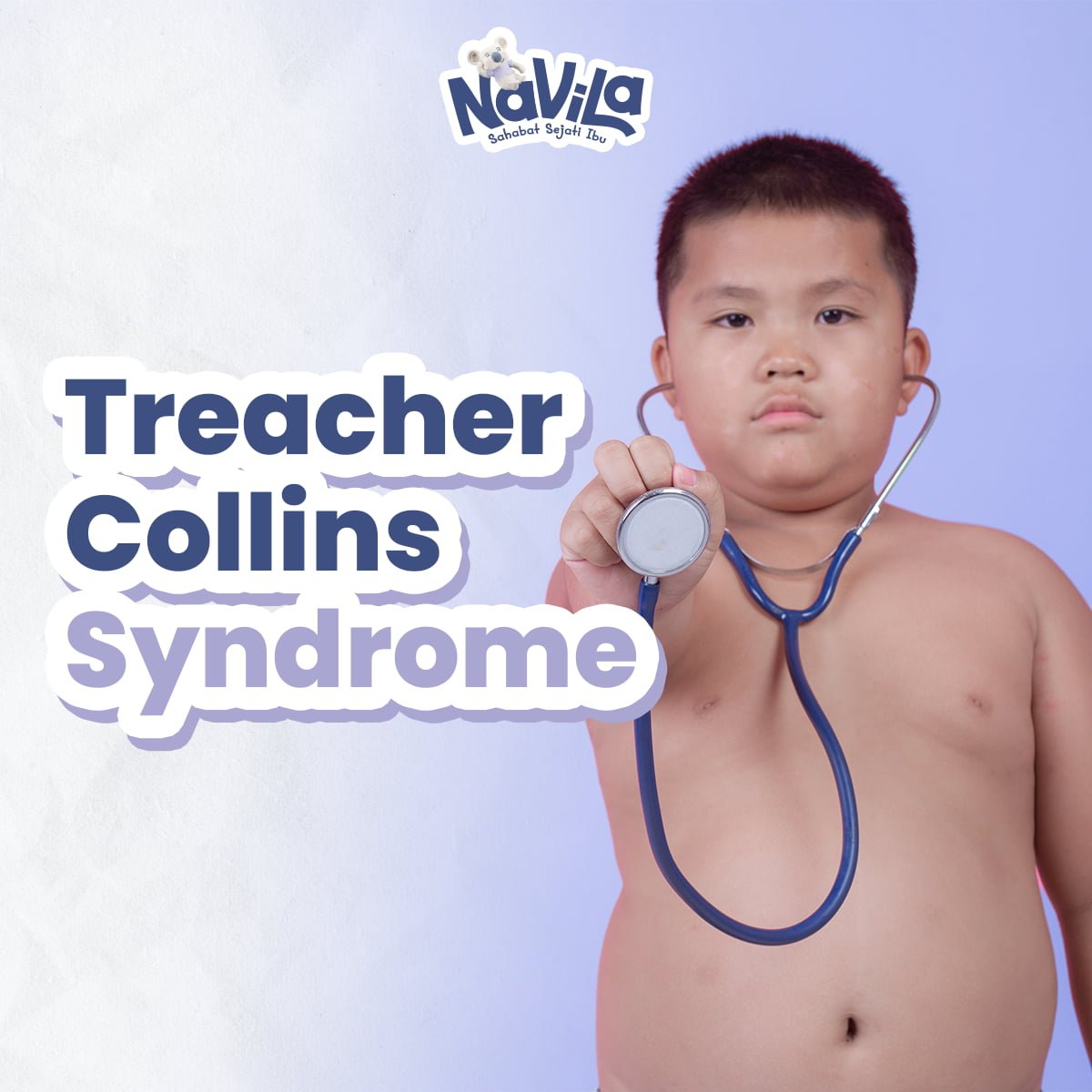 Penyebab Gangguan Pertumbuhan Wajah atau Treacher Collins Syndrome