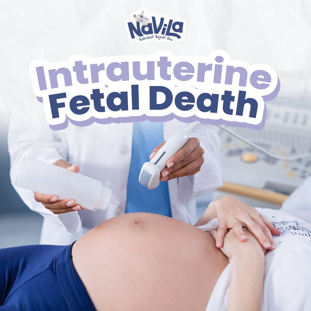 Penyebab Kematian Janin Dini atau Intrauterine Fetal Death serta Cara Mencegahnya