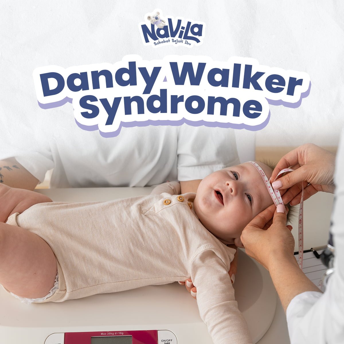 Penyebab Sindrom Pembesaran Kepala atau Dandy Walker Syndrome