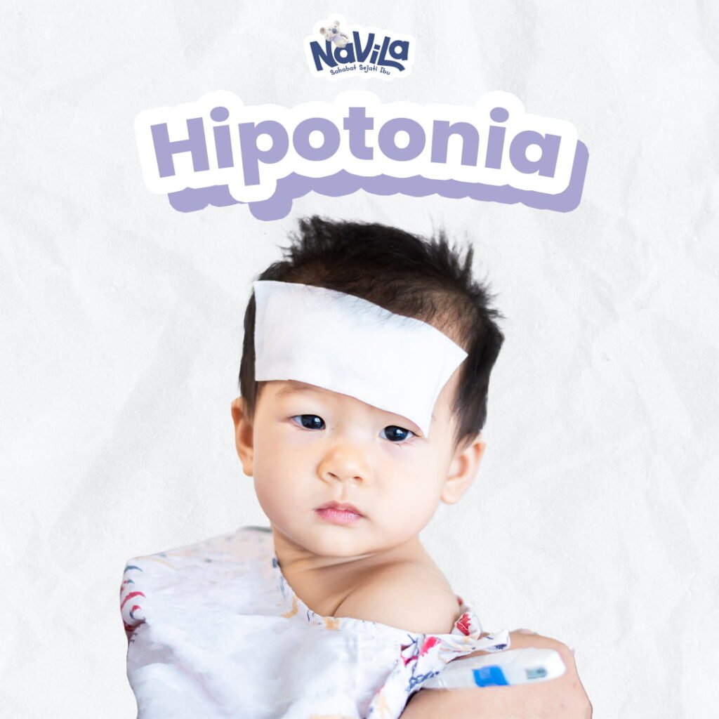 Anak Terlihat Lemas dan Terlambat Duduk Kenali Tanda Hipotonia Sejak Dini