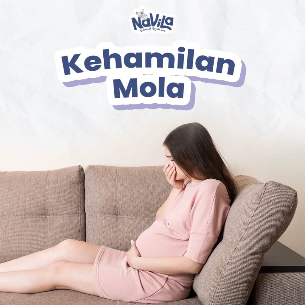 Kehamilan Mola dan Langkah Penanganannya yang Perlu Diketahui Ibu Hamil