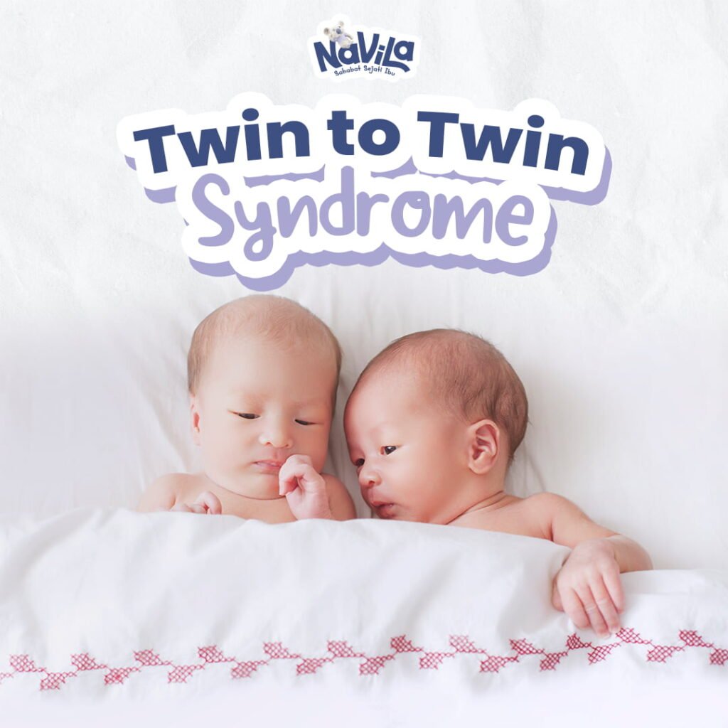 Mengenal Twin to Twin Transfusion Syndrome pada Kehamilan Kembar