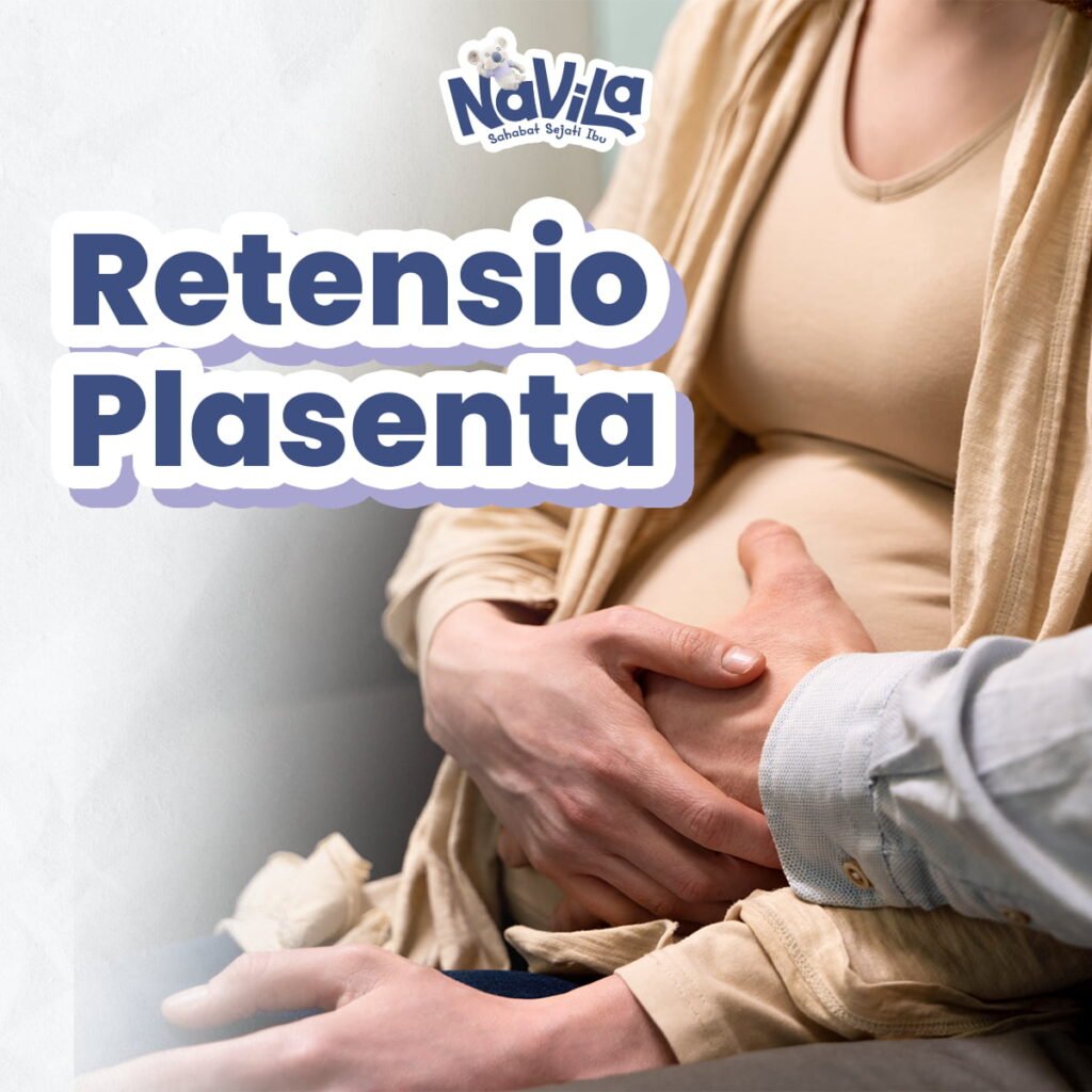 Penyebab Ari-Ari Tidak Keluar Setelah Persalinan, Kenali Retensio Plasenta