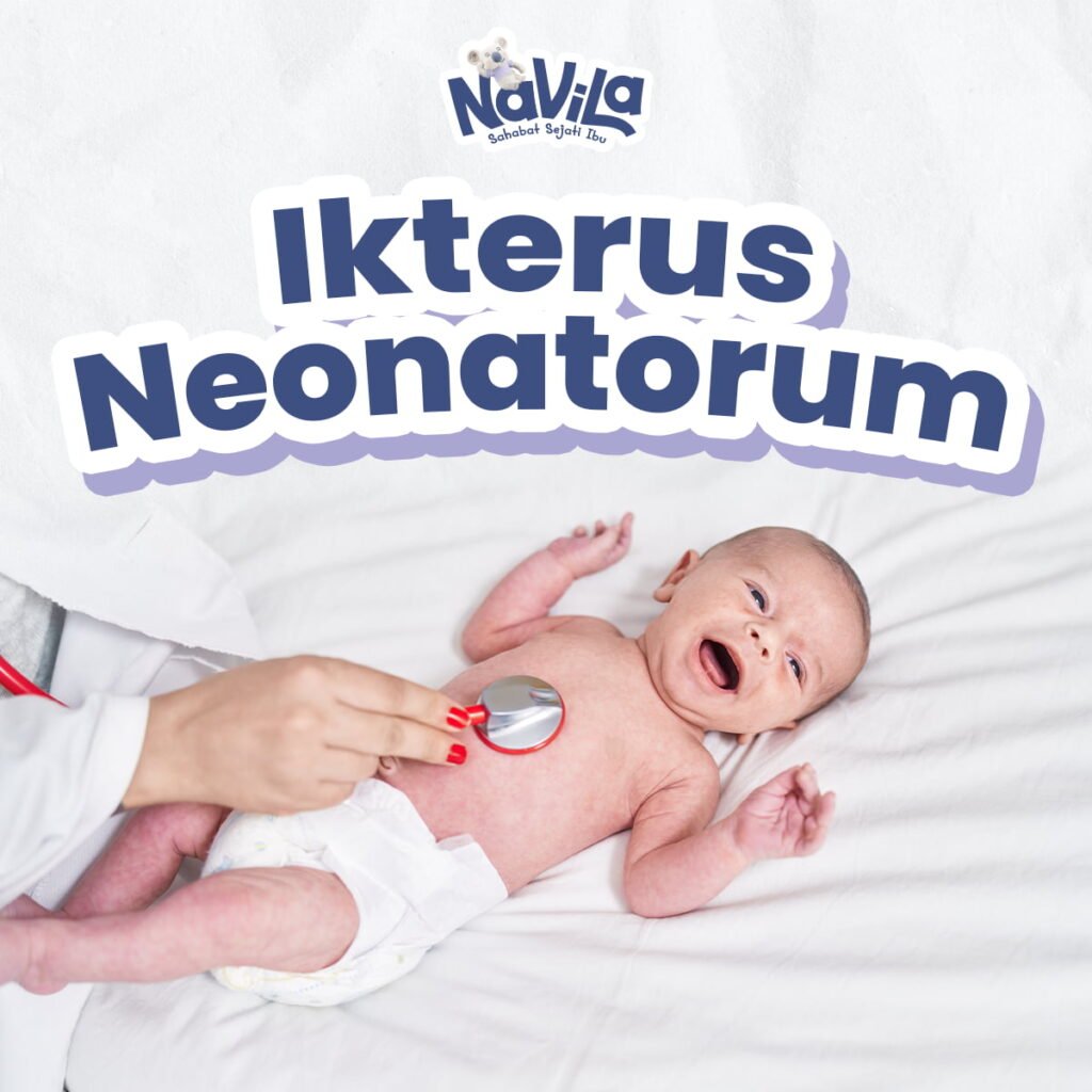 Perbedaan Penyakit Kuning Normal dan Fatal (Patologis) pada Bayi