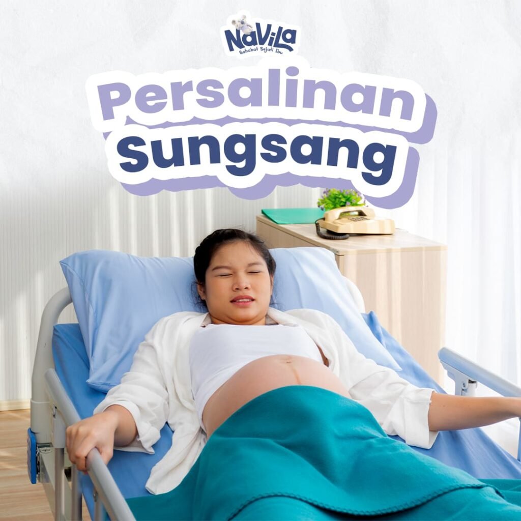 Persalinan Sungsang dan Pilihan Penanganan yang Aman bagi Ibu dan Bayi