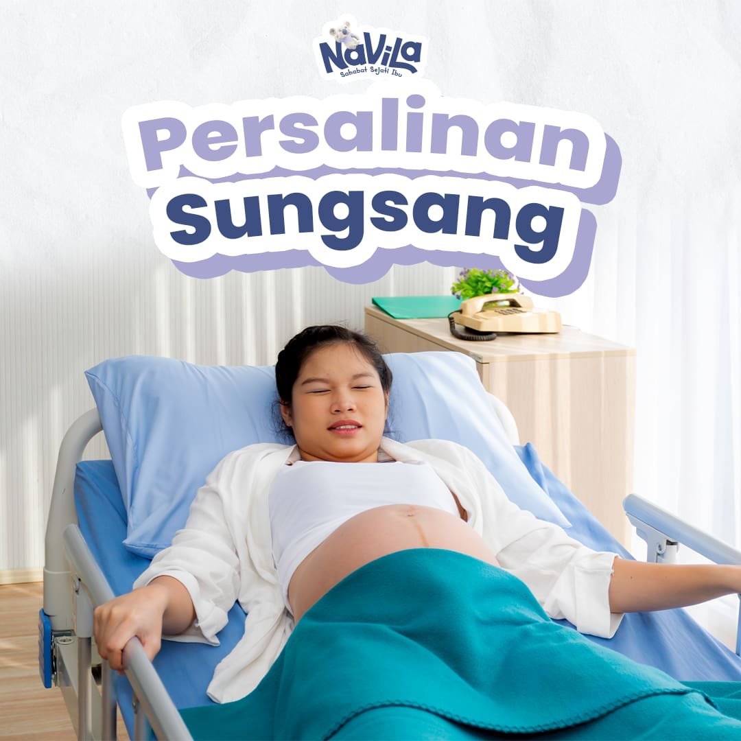 Persalinan Sungsang dan Pilihan Penanganan yang Aman bagi Ibu dan Bayi