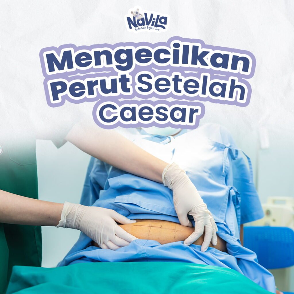 Cara Mengecilkan Perut setelah Operasi Caesar dengan Aman dan Efektif
