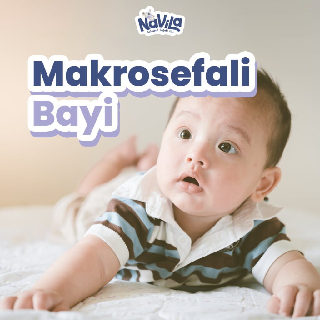 Makrosefali pada Bayi dan Anak serta Pemeriksaan yang Diperlukan