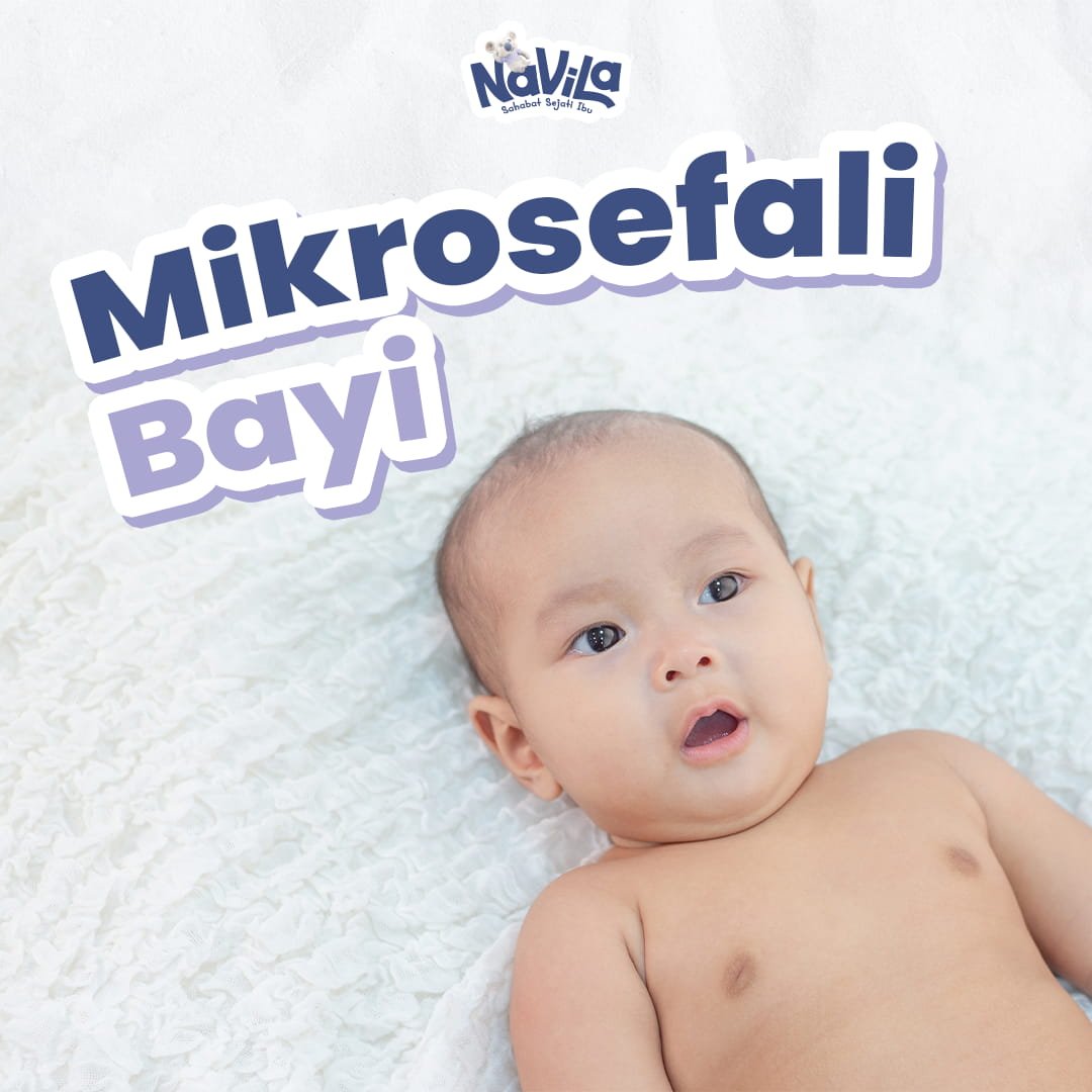 Mikrosefali dan Dampaknya terhadap Perkembangan Otak Bayi