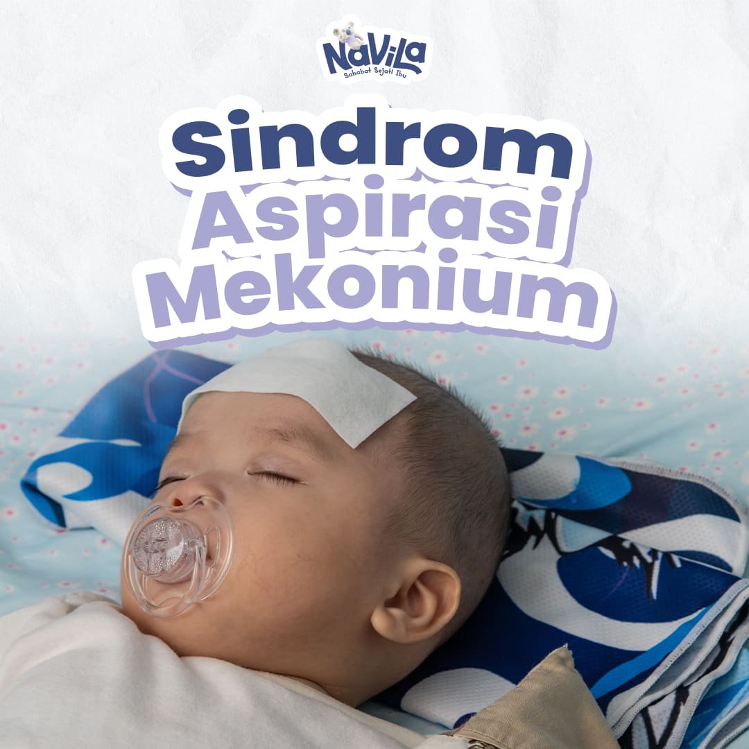 Waspadai Sindrom Aspirasi Mekonium pada Bayi Baru Lahir