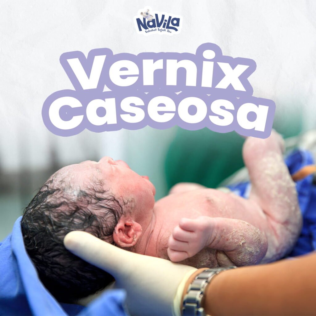 Vernix Caseosa dan Manfaatnya untuk Kulit Bayi Baru Lahir