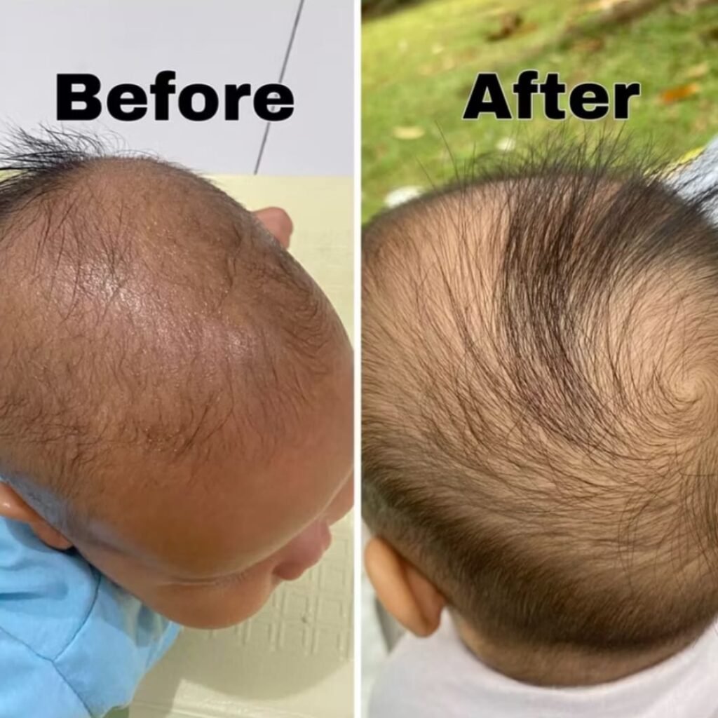 Testimoni Navila Candlenut Oil